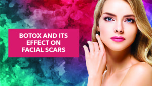 Botox and its Effect on Facial Scars - Plastic Surgery Houston ...