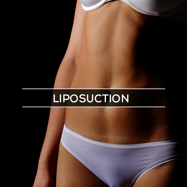 Liposuction Before and after